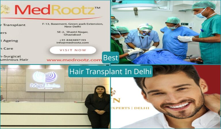 Best Hair Transplant In Delhi